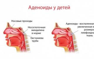 Vad är adenoider i näsan?