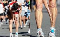 What to do if your calf muscle is cramped