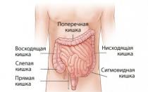 Método de tratamiento del síndrome del intestino irritable en el resort Gastroduodenitis y embarazo.