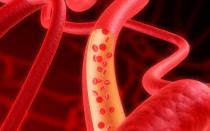 Как да приемате кардиомагнил преди или след хранене