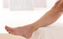 Causes of pain in leg muscles at night