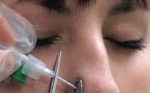 How to pierce your nose without drops at home